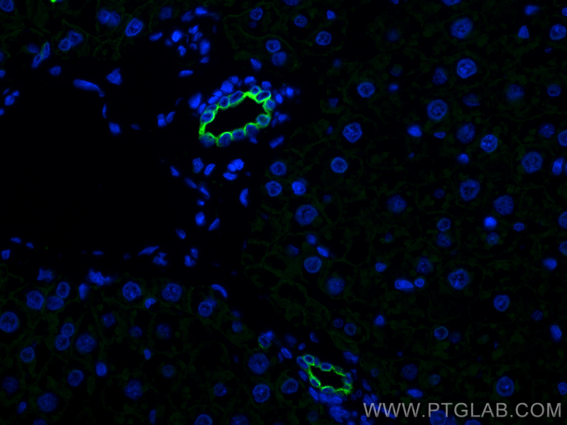 IF Staining of rat liver using 15539-1-AP