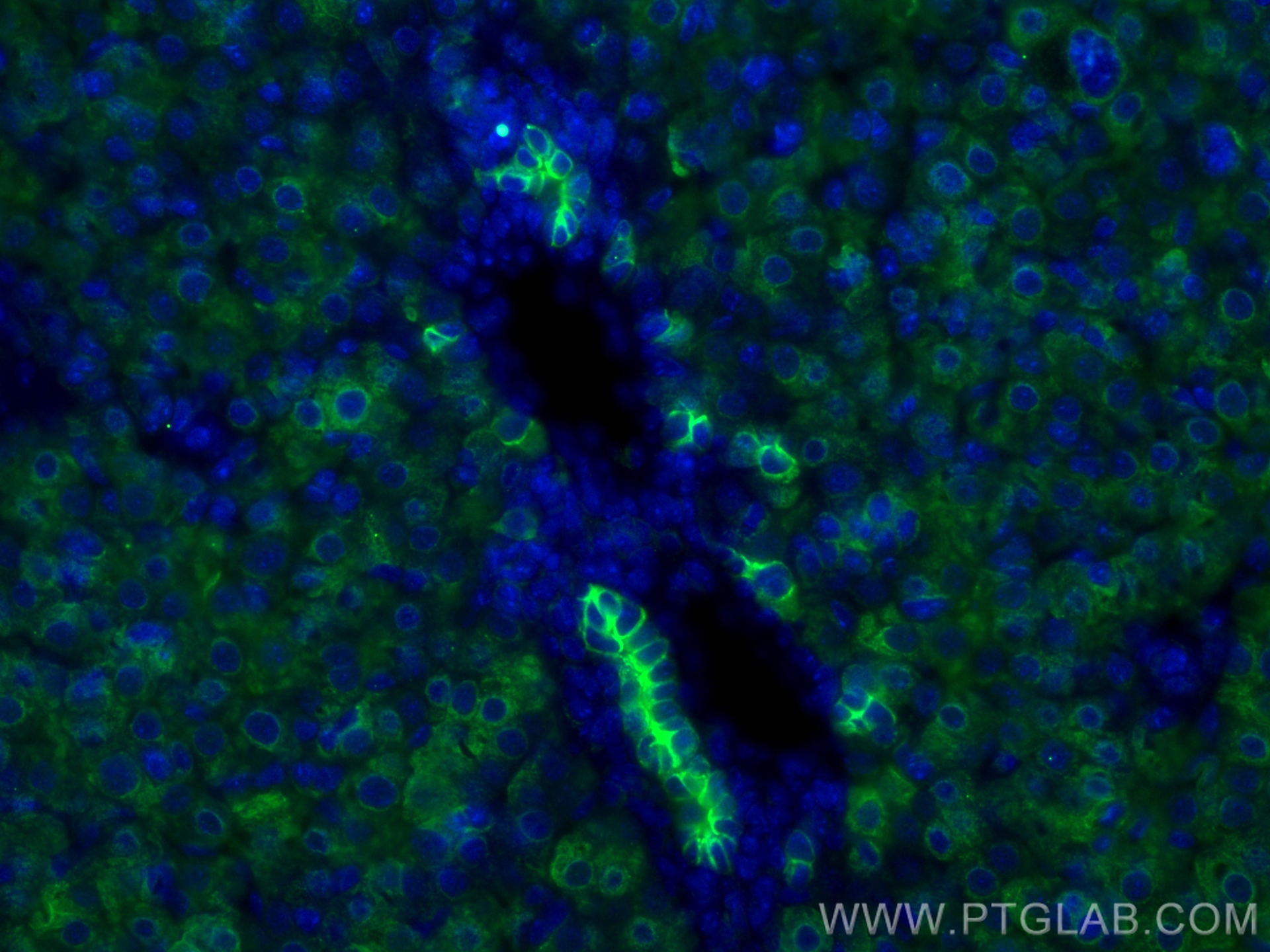 IF Staining of mouse liver using 22208-1-AP