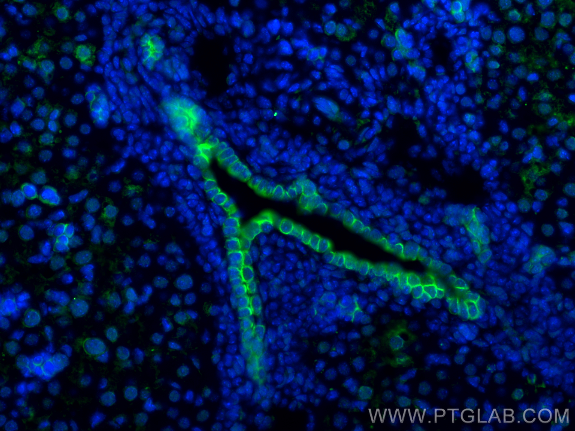 IF Staining of mouse liver using 17513-1-AP