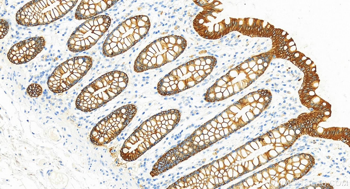 IHC staining of human colon using 10384-1-AP