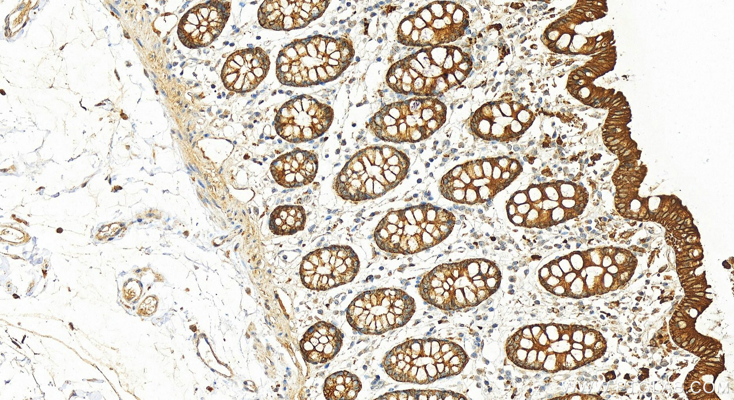 Cytokeratin 8