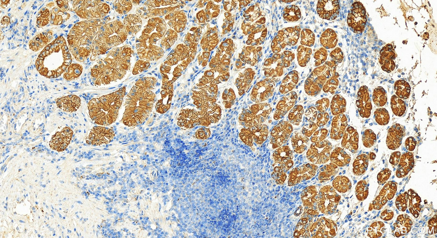 IHC staining of human stomach using 17514-1-AP