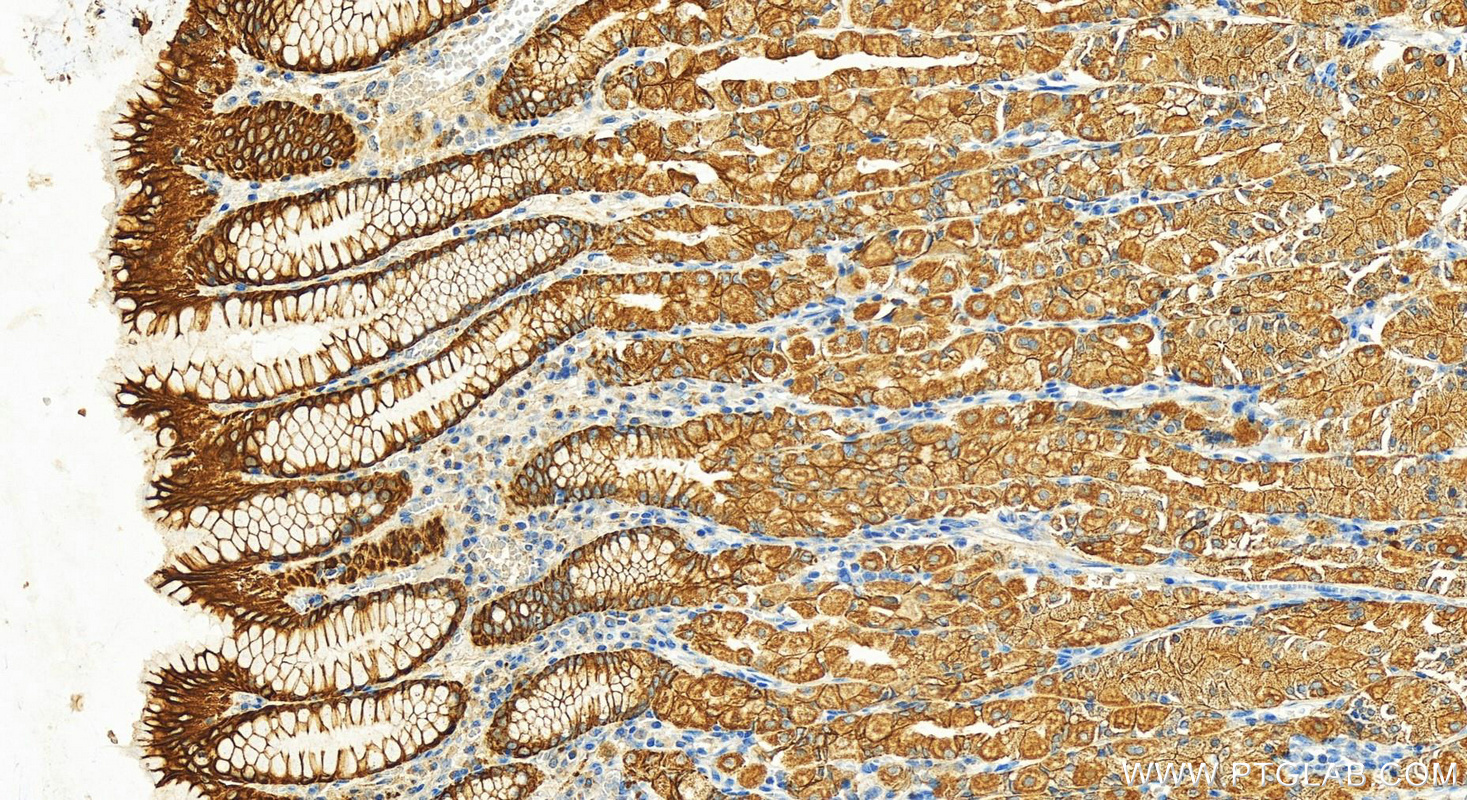 IHC staining of human stomach using 17514-1-AP