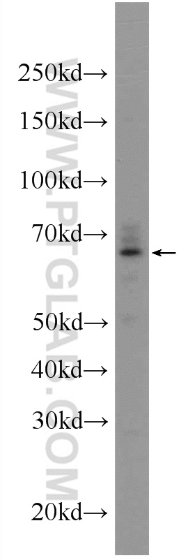 WB analysis of HepG2 using 24409-1-AP