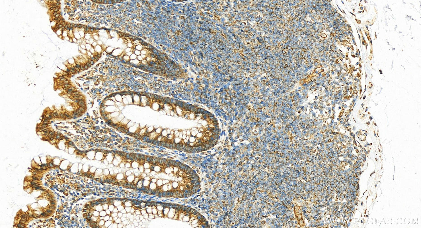 IHC staining of human colon using 19841-1-AP