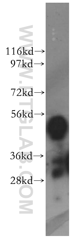 WB analysis of HeLa using 11796-1-AP