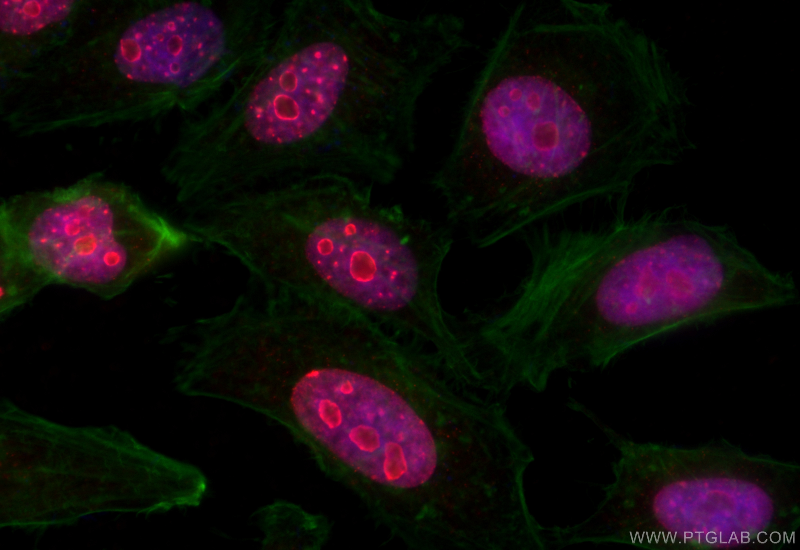 IF Staining of HeLa using 32270-1-AP