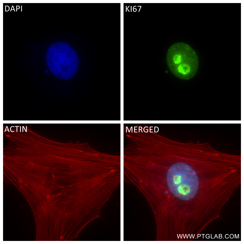 IF Staining of HeLa using 84192-4-RR