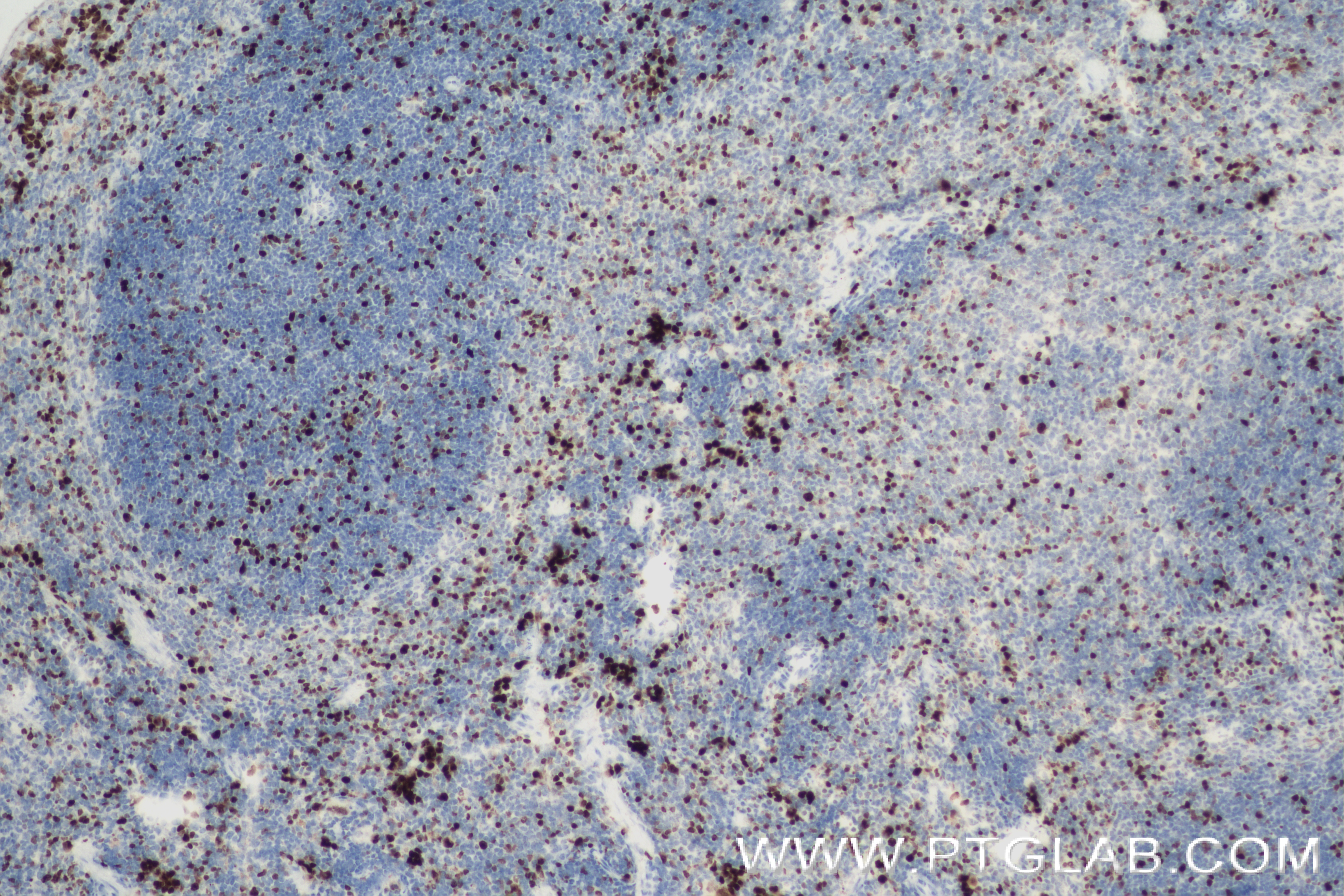 IHC staining of mouse spleen using 84432-1-RR (same clone as 84432-1-PBS)