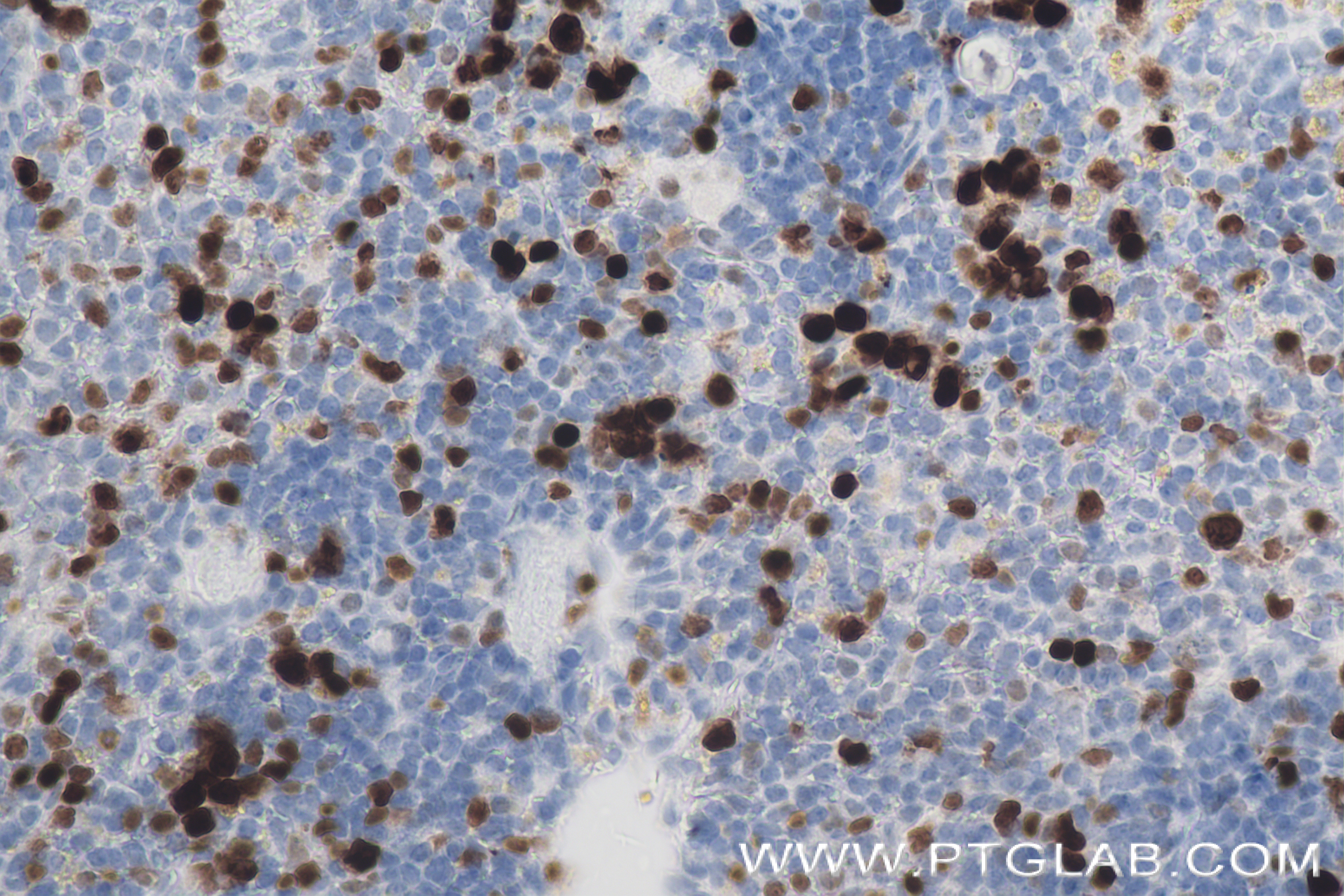 IHC staining of mouse spleen using 84432-1-RR (same clone as 84432-1-PBS)