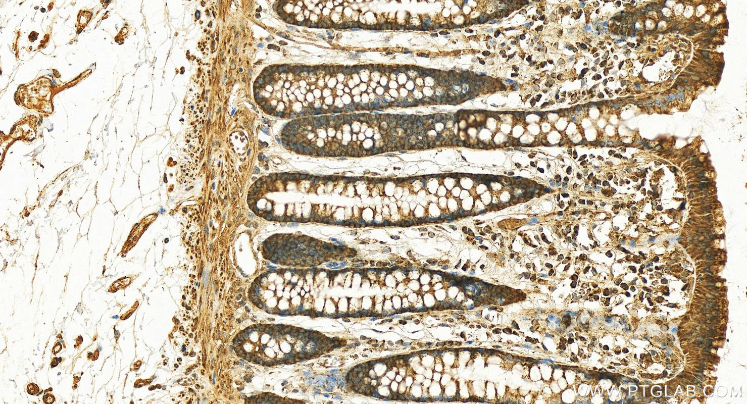 IHC staining of human normal colon using 29911-1-AP