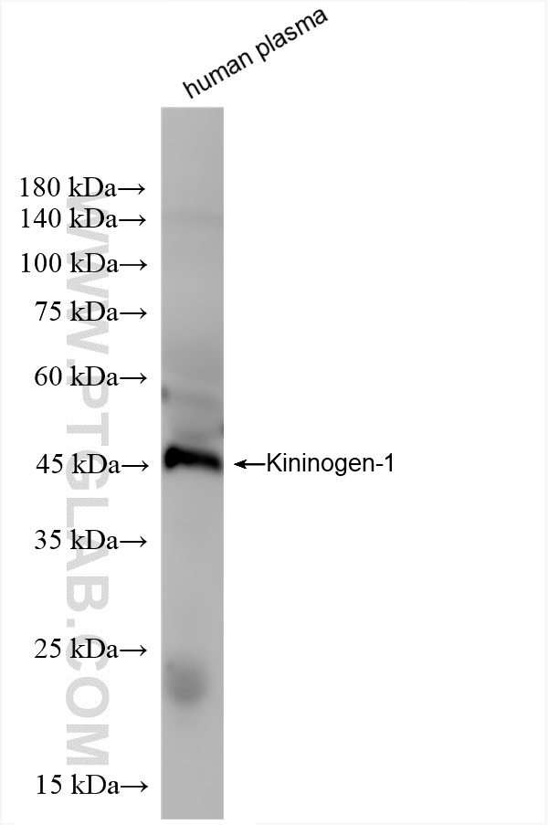 WB analysis of human plasma using 84175-5-RR (same clone as 84175-5-PBS)