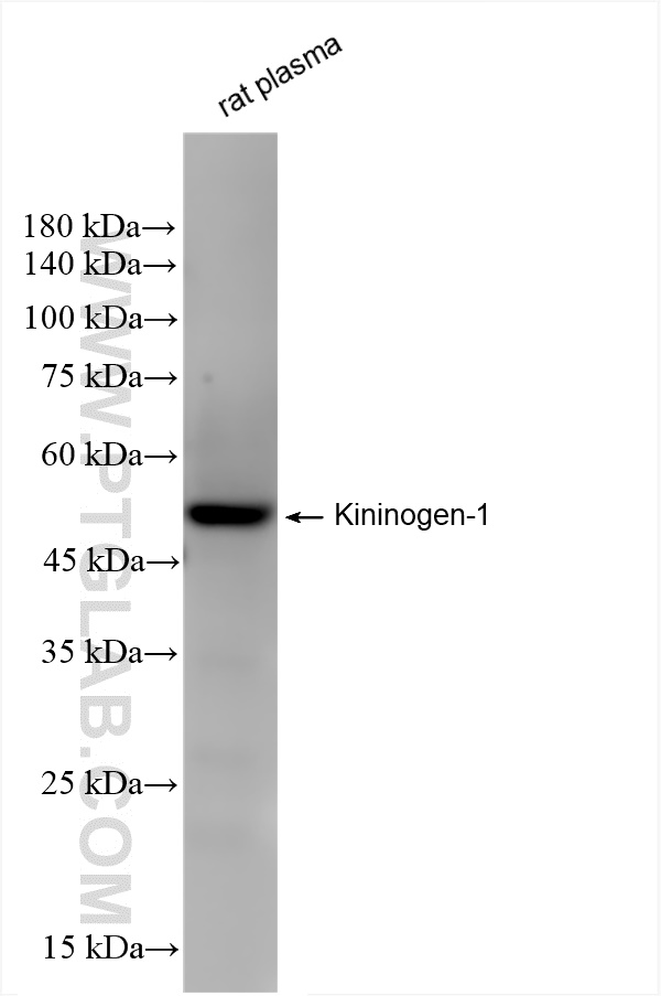 WB analysis of rat plasma using 84175-5-RR (same clone as 84175-5-PBS)