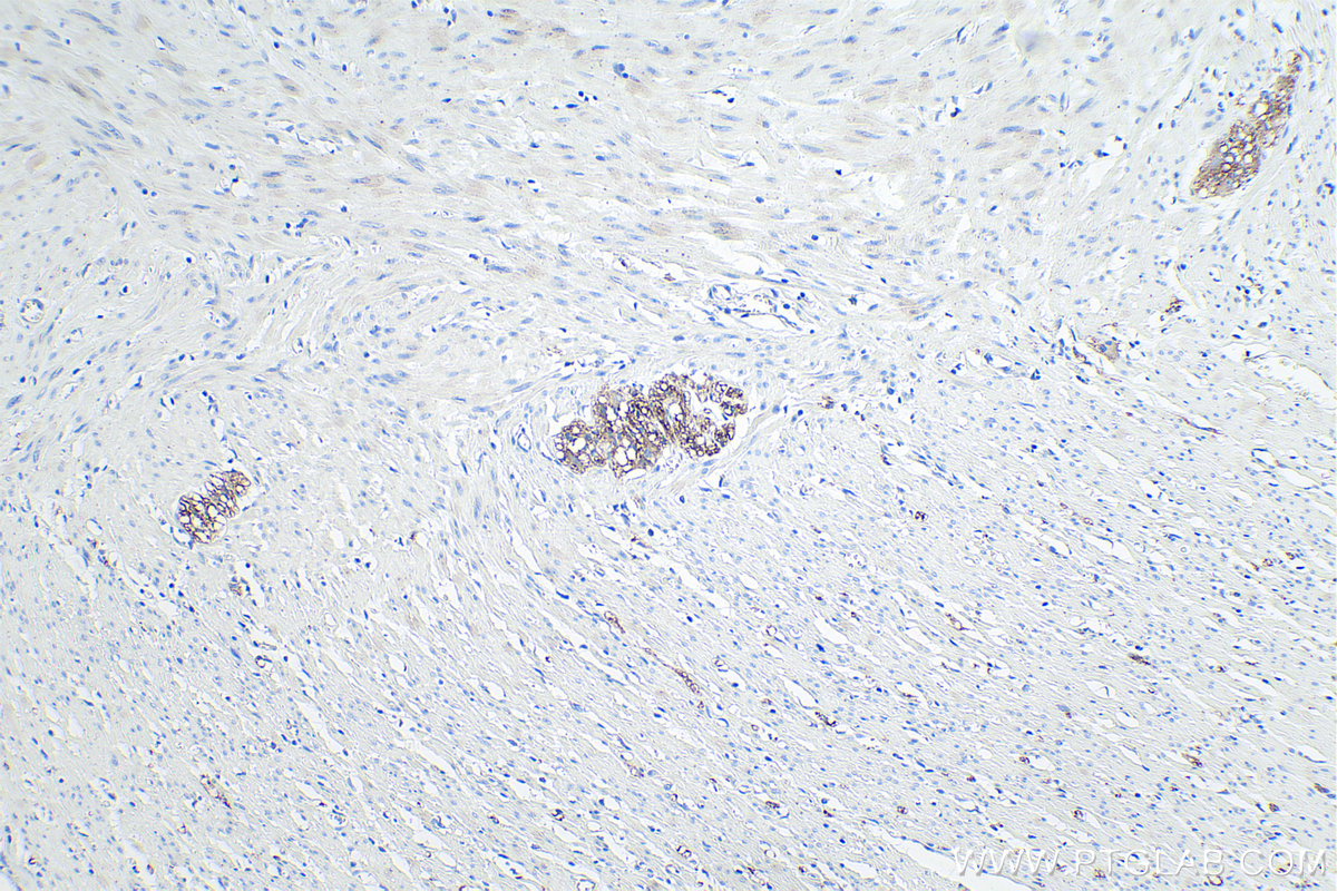 IHC staining of human colon using 67115-1-Ig