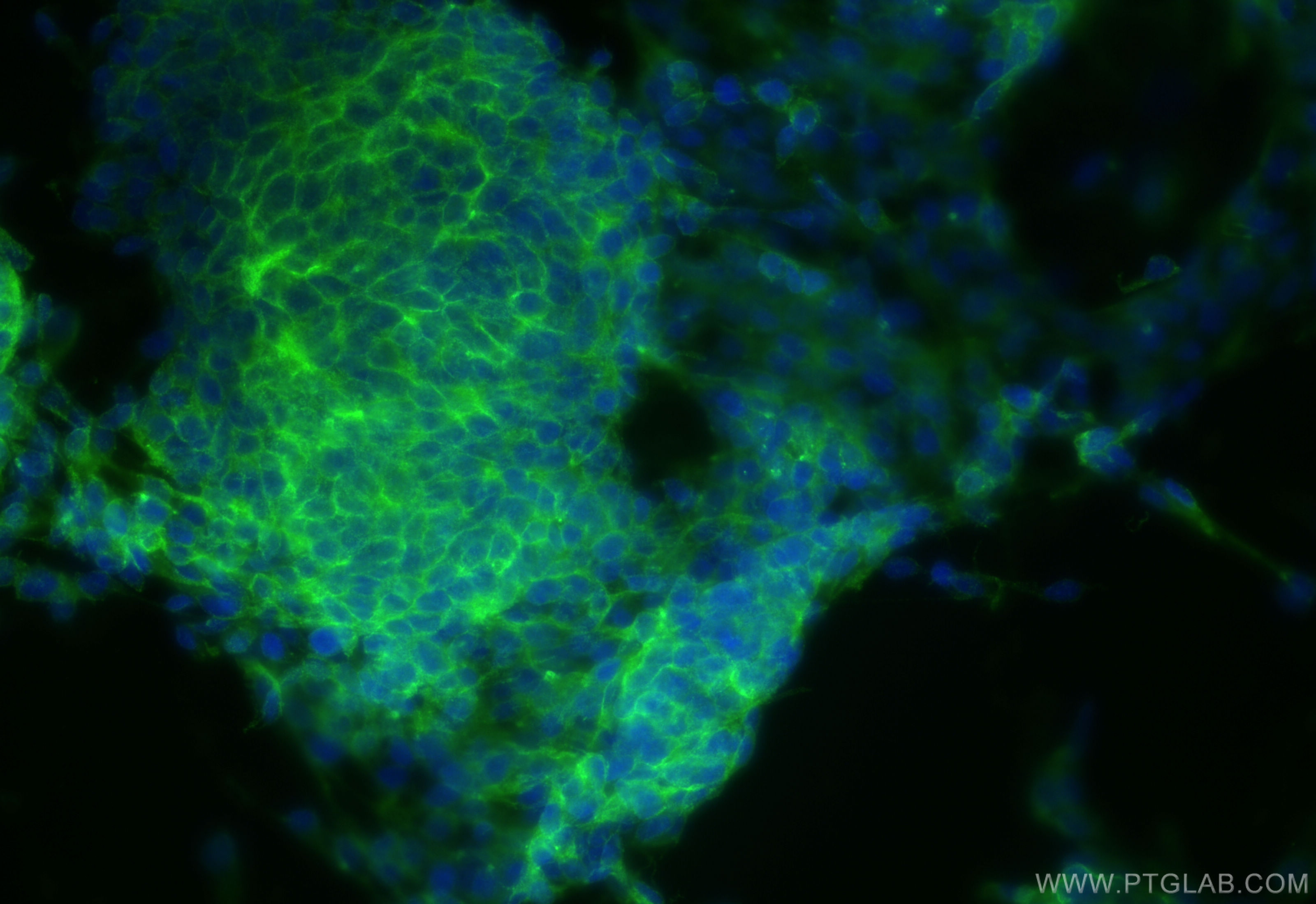 IF Staining of SH-SY5Y using 84034-5-RR (same clone as 84034-5-PBS)