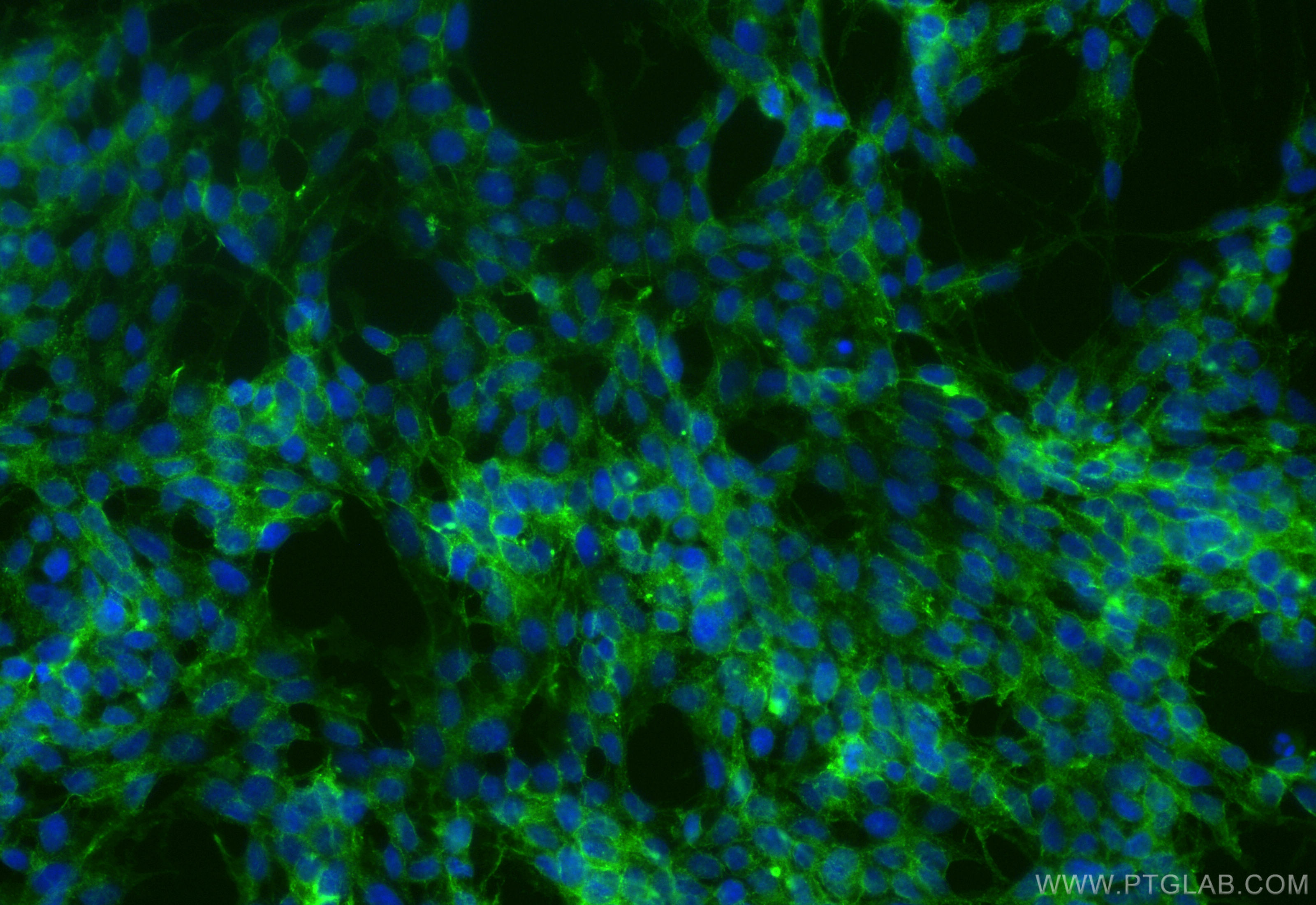 IF Staining of SH-SY5Y using CL488-84034-5