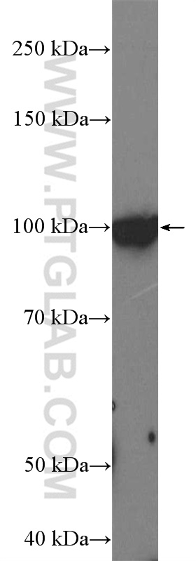 WB analysis of NCCIT cells using 21528-1-AP