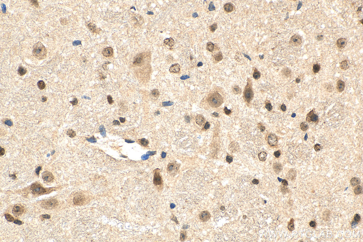 IHC staining of mouse cerebellum using 28112-1-AP