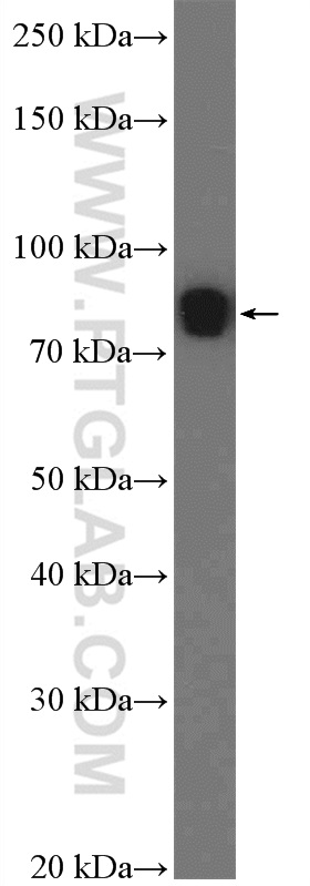 WB analysis of mouse testis using 26280-1-AP