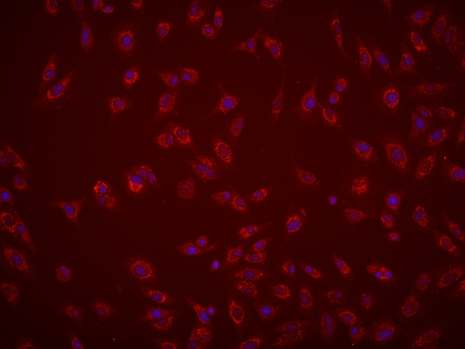 IF Staining of A549 using 66785-1-Ig