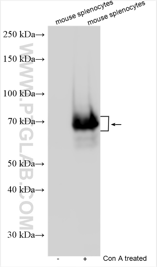 WB analysis using 31722-1-AP