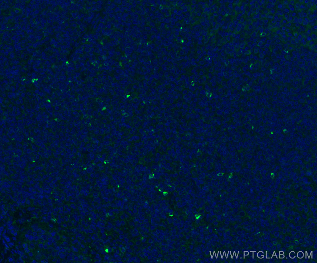 IF Staining of human tonsillitis using 29548-1-AP