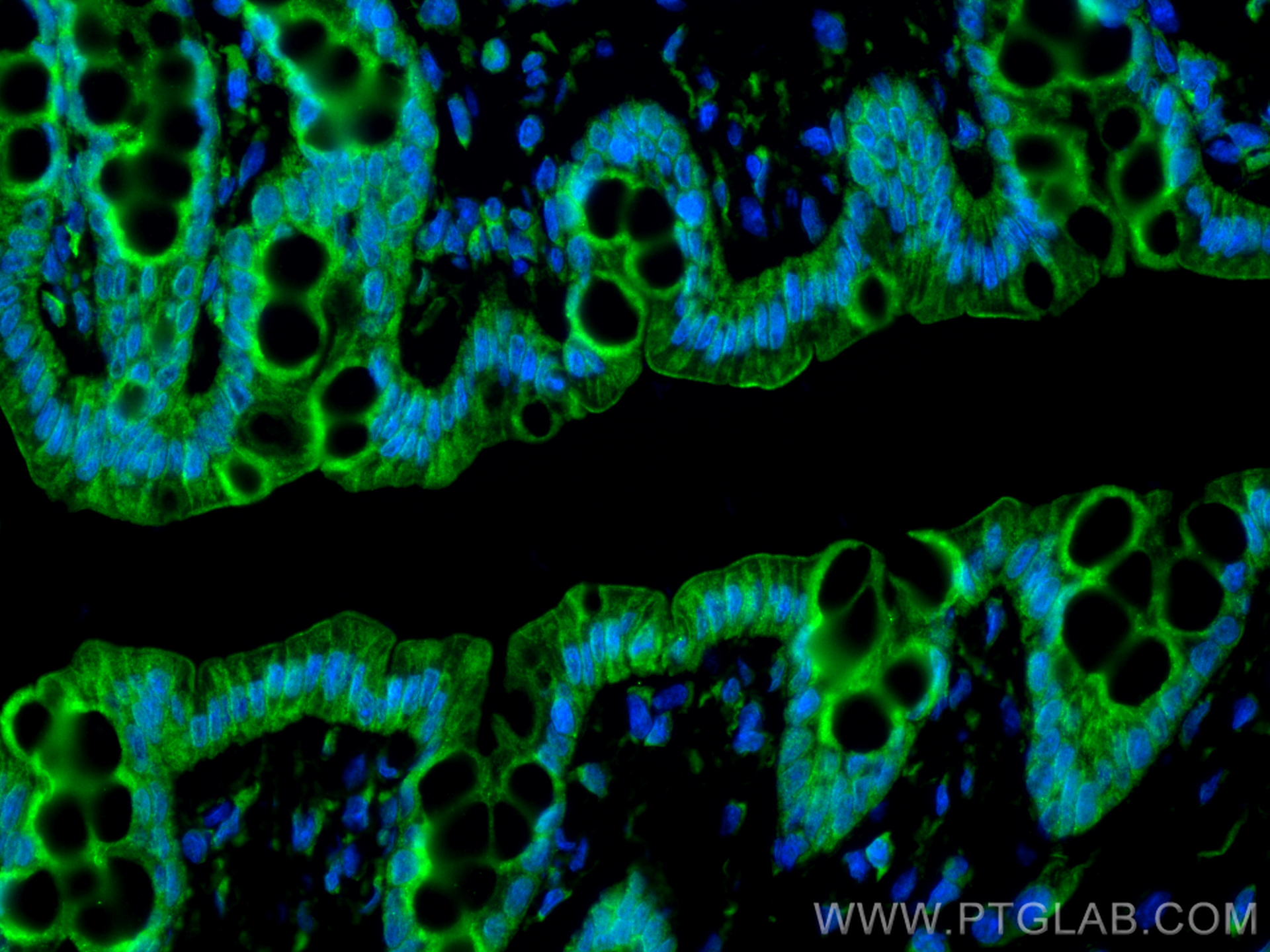 IF Staining of rat colon using 28697-1-AP