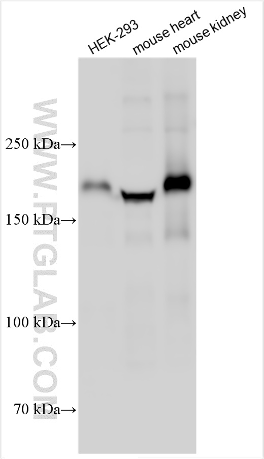 WB analysis using 30943-1-AP