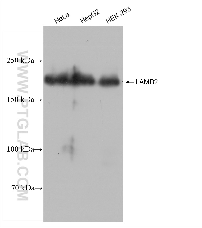 WB analysis using 82946-1-RR