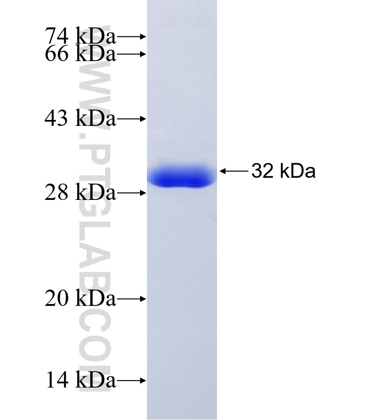 LAMB2 fusion protein Ag33456 SDS-PAGE