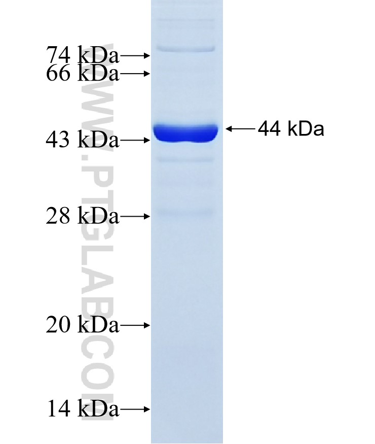 LAMB3 fusion protein Ag25197 SDS-PAGE