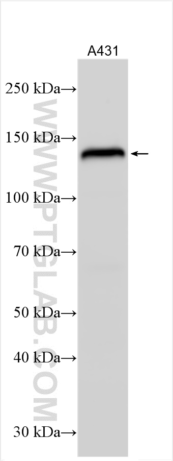 WB analysis of A431 using 19698-1-AP