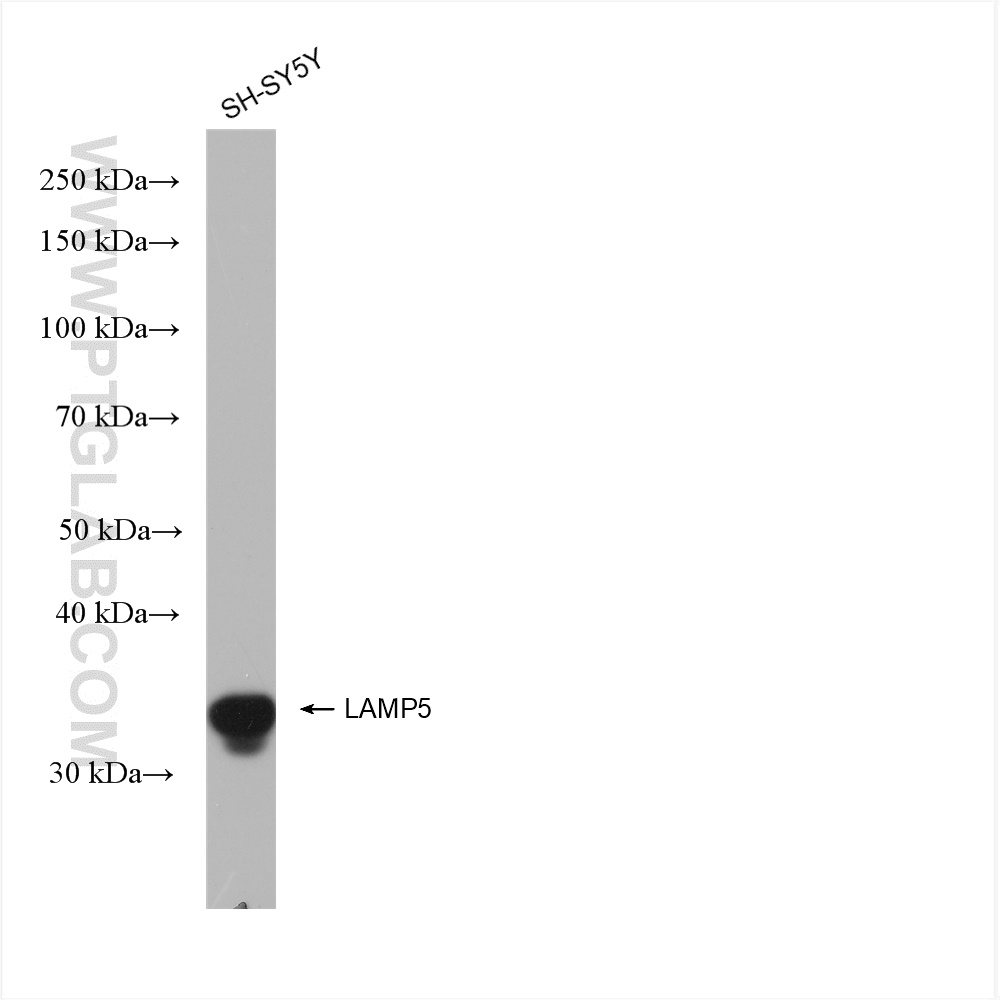 WB analysis using 82992-2-RR