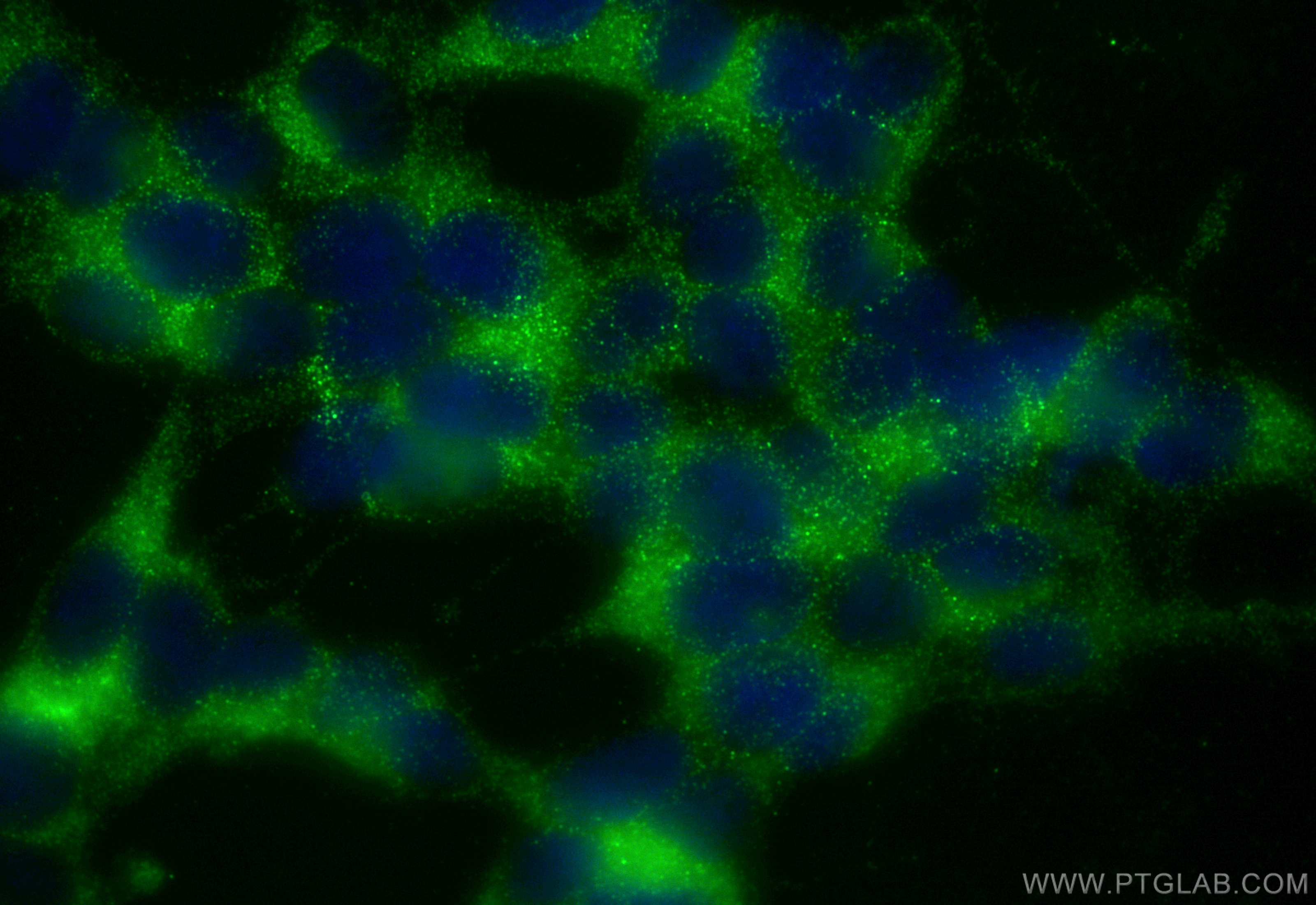 IF Staining of SH-SY5Y using CL488-82992-2