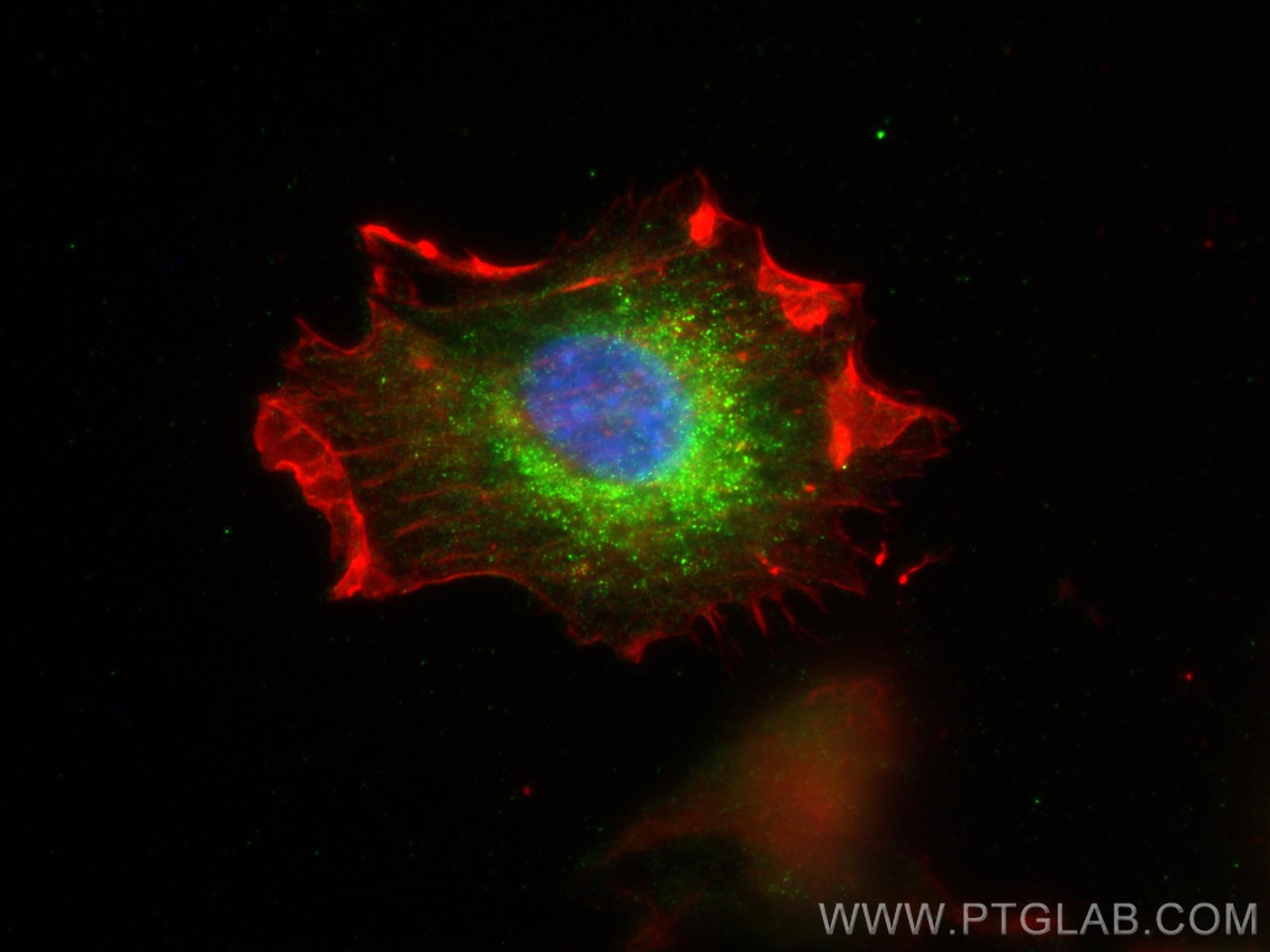 IF Staining of U-87 MG using 29611-1-AP