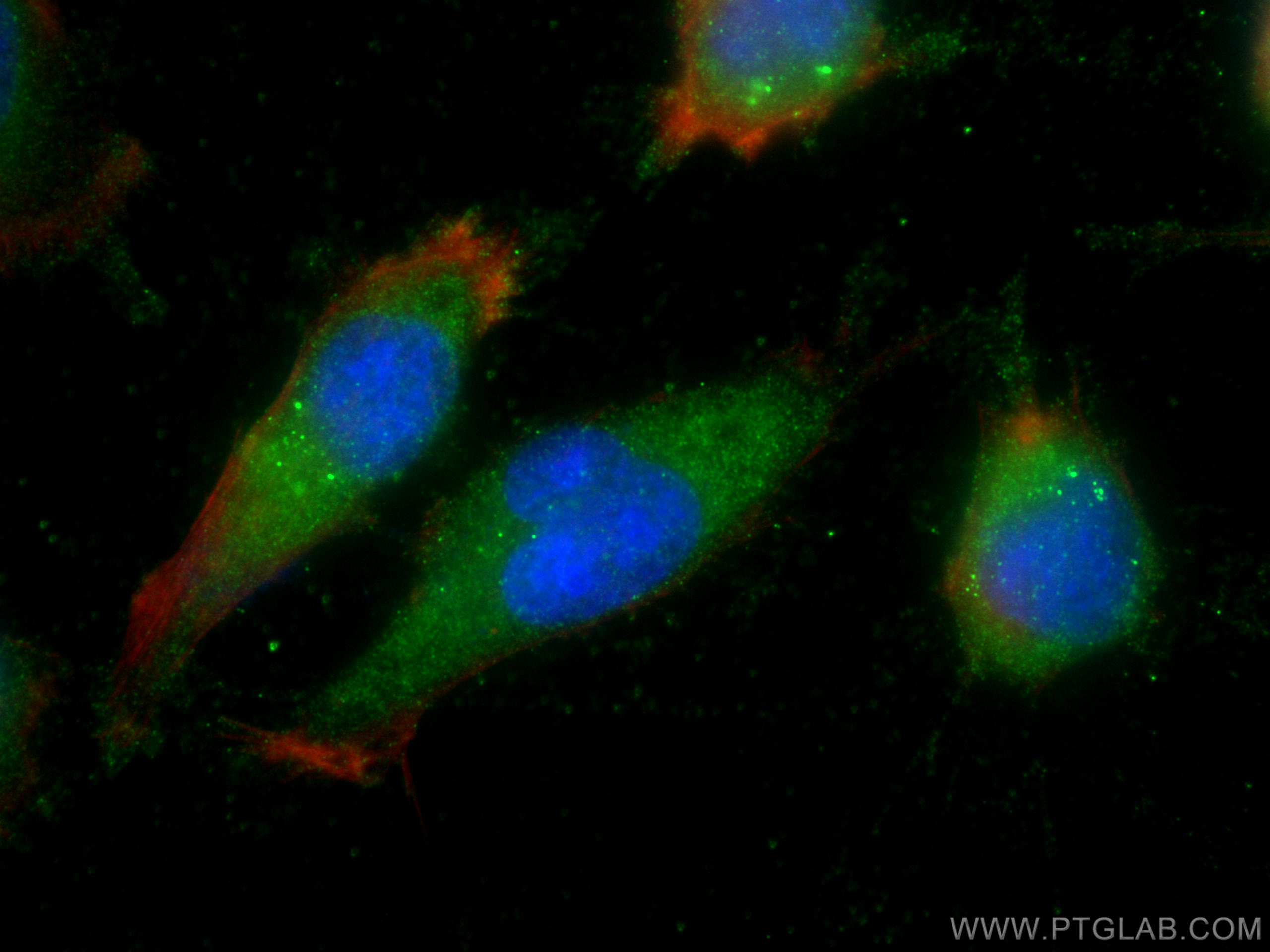 IF Staining of U-251 using 68160-1-Ig (same clone as 68160-1-PBS)