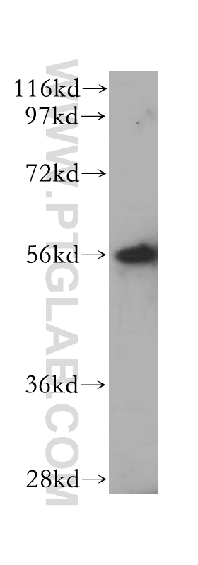 WB analysis of HeLa using 14612-1-AP