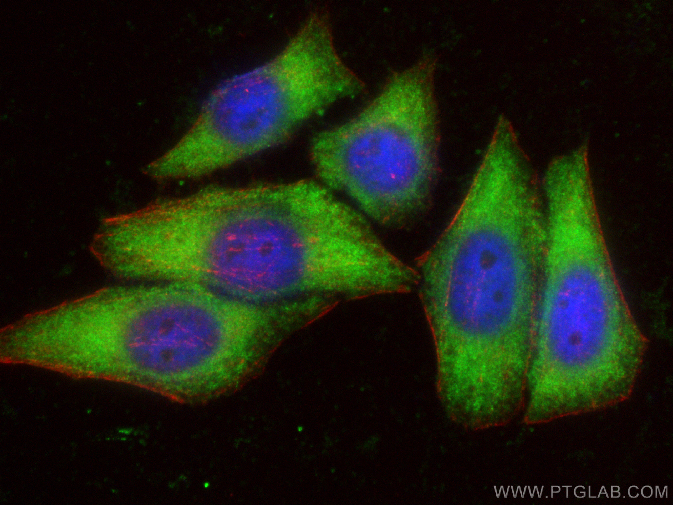 IF Staining of HepG2 using 13708-1-AP