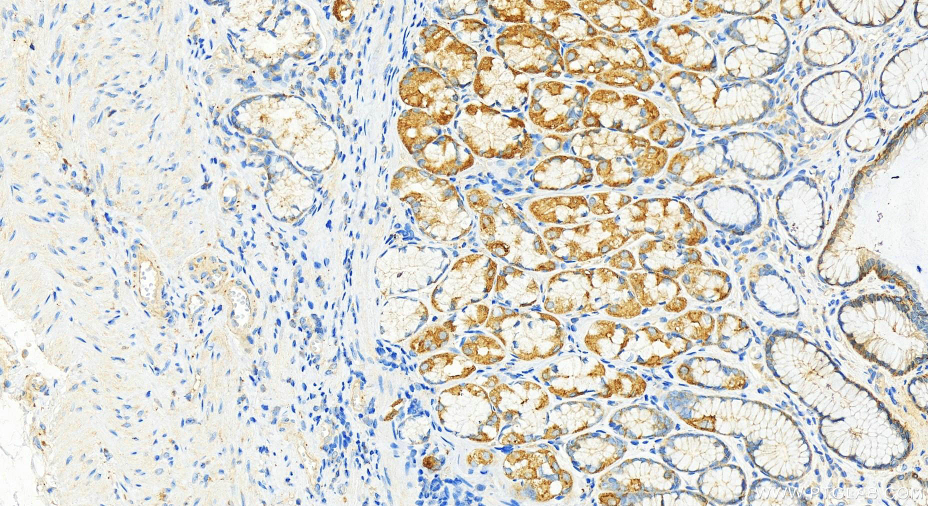 IHC staining of human stomach using 82491-1-RR