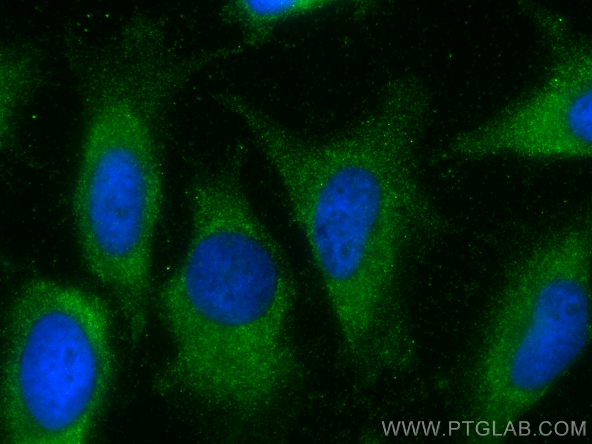 IF Staining of HeLa using 82491-1-RR (same clone as 82491-1-PBS)