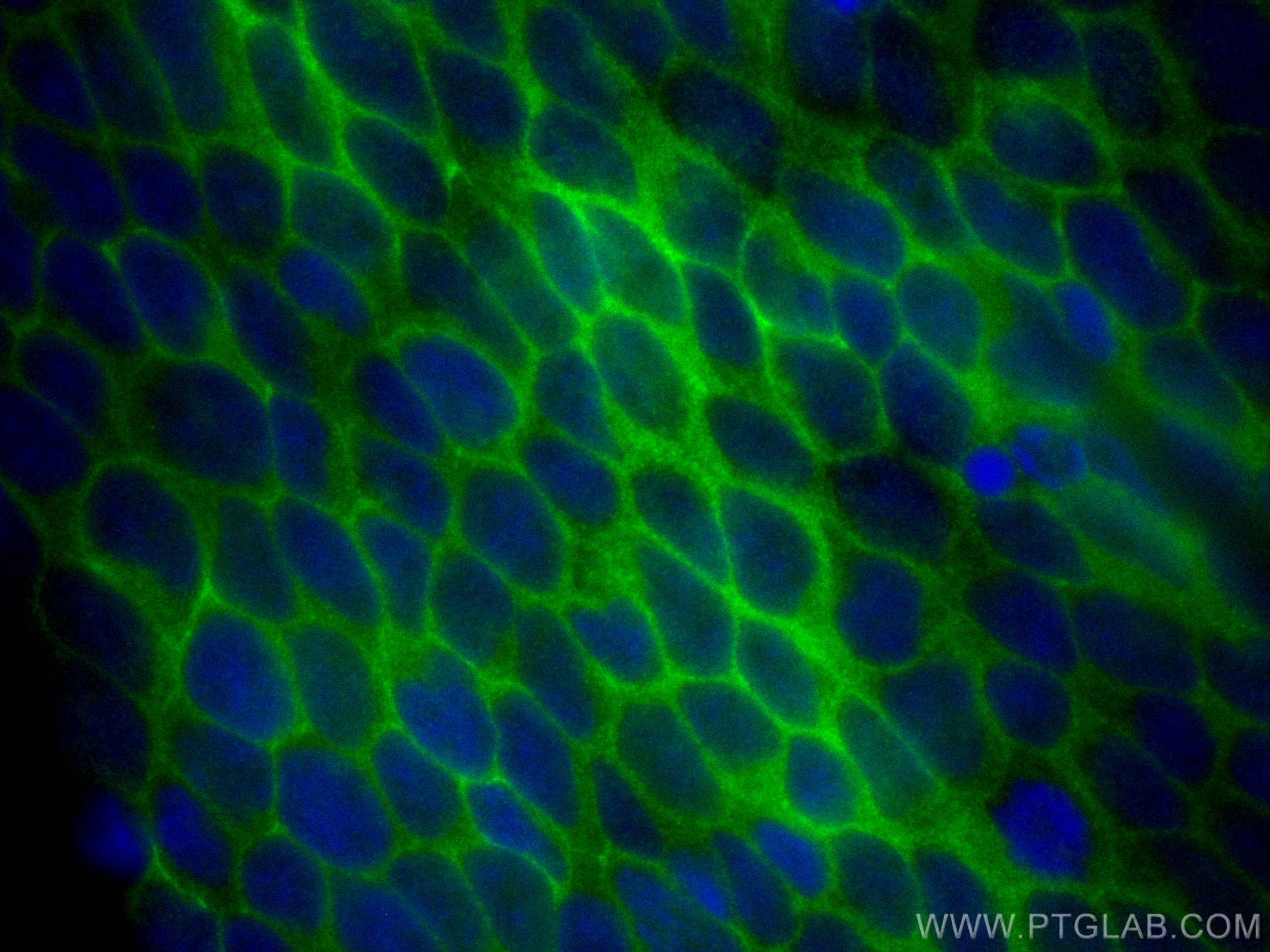 IF Staining of Jurkat using CL488-82901