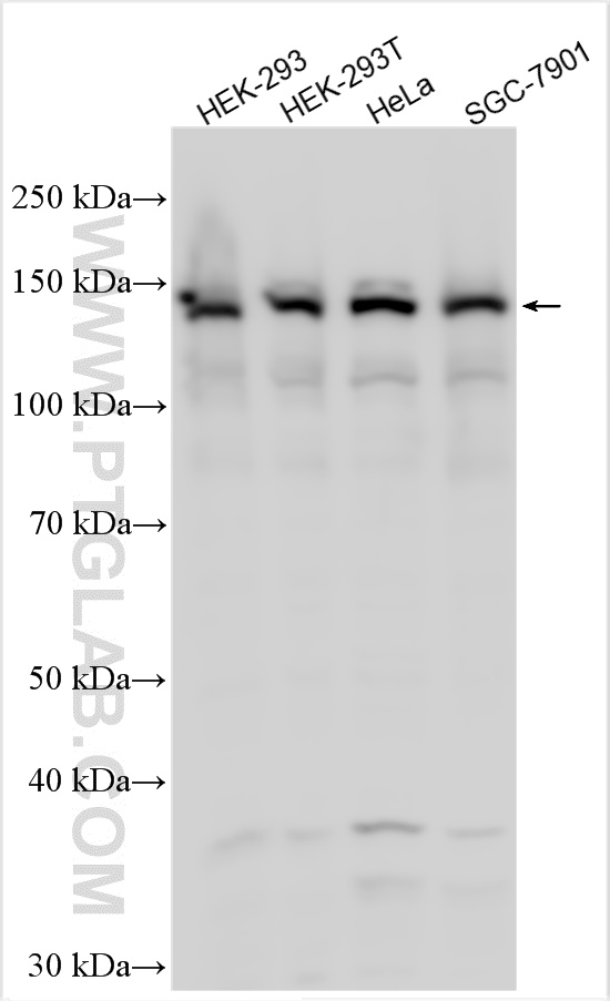 WB analysis using 20276-1-AP