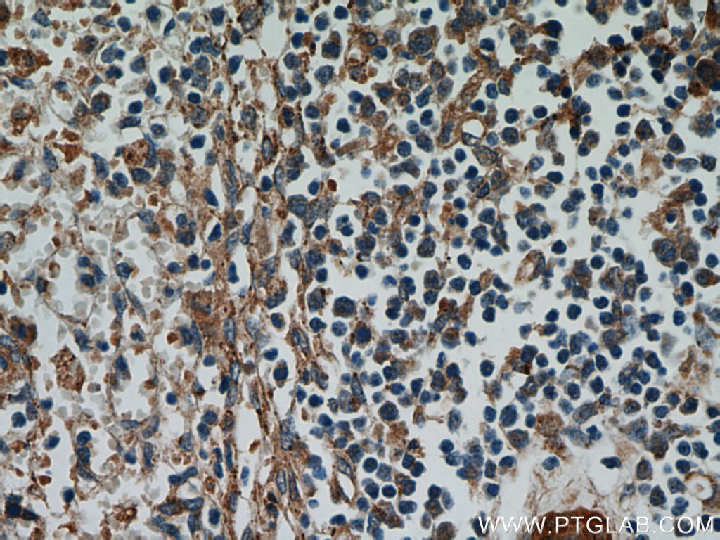 IHC staining of human spleen using 21557-1-AP