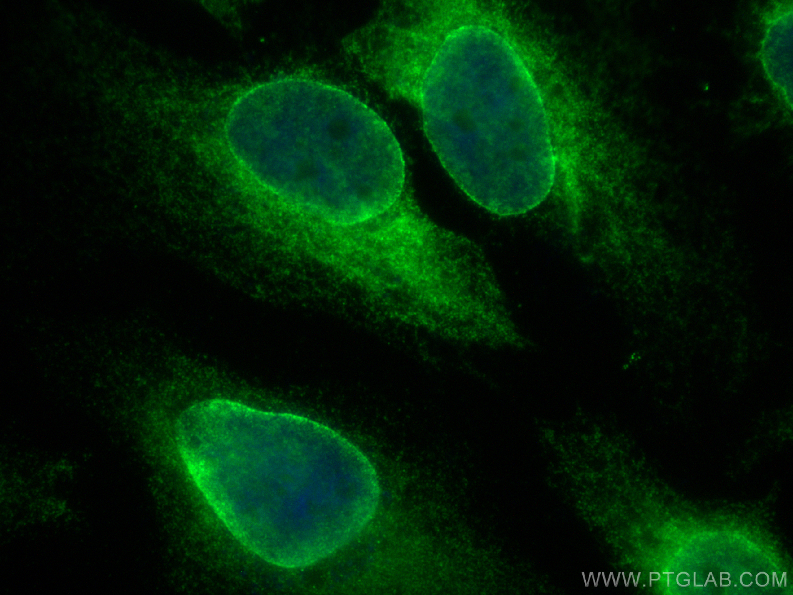 IF Staining of HeLa using 12398-1-AP