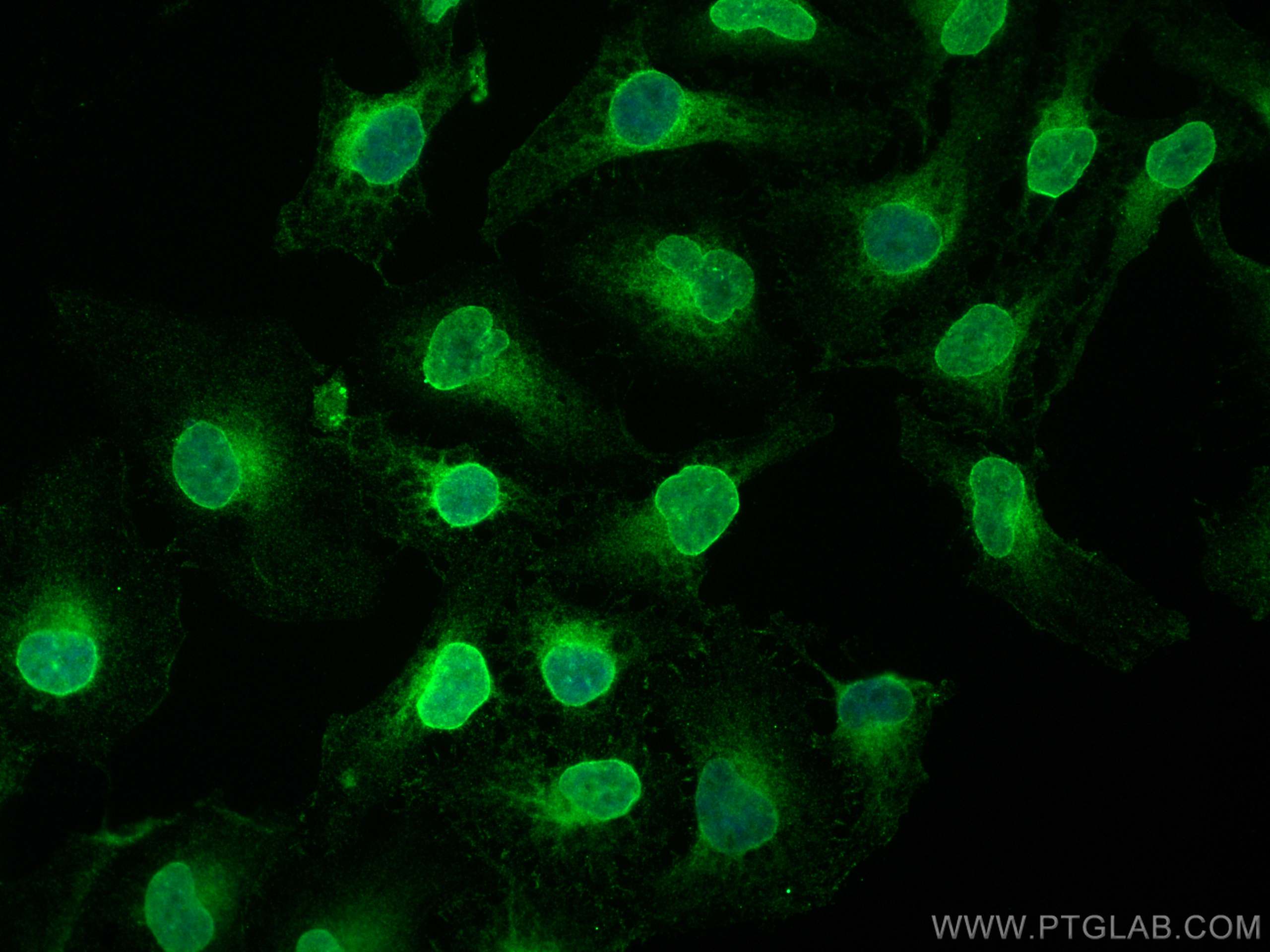 IF Staining of HeLa using 68378-1-Ig