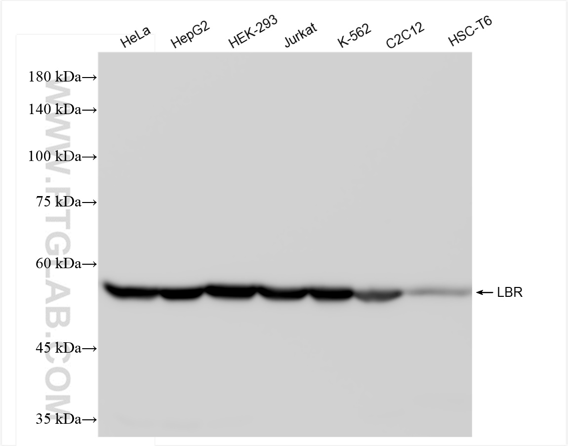 WB analysis using 84522-6-RR (same clone as 84522-6-PBS)