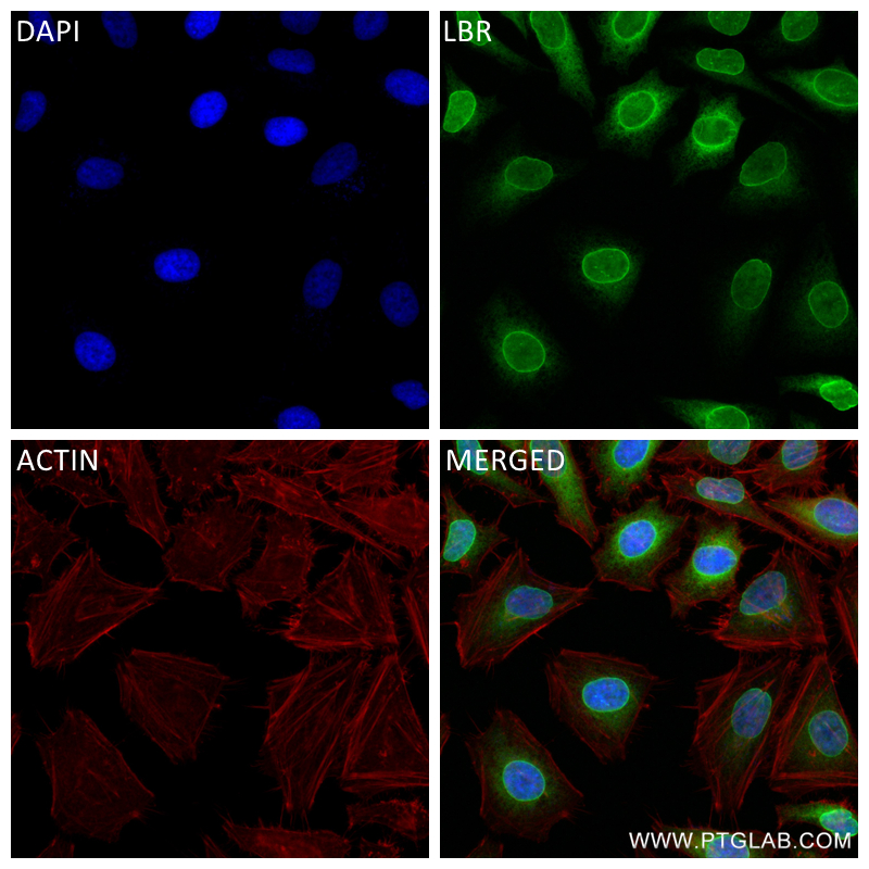 IF Staining of HeLa using 84522-7-RR (same clone as 84522-7-PBS)