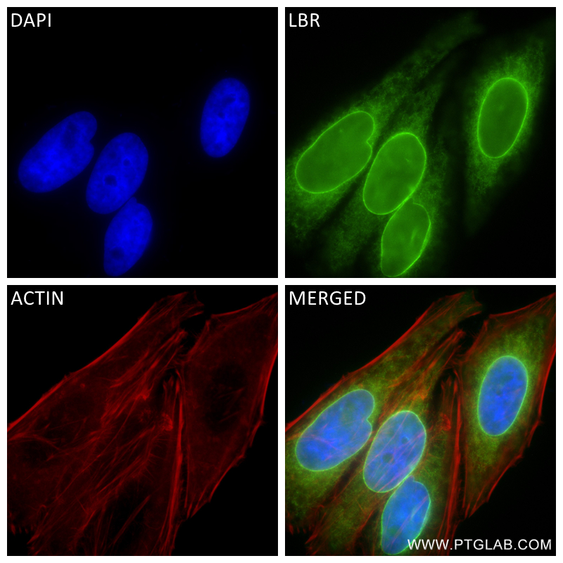 IF Staining of HepG2 using 84522-7-RR (same clone as 84522-7-PBS)