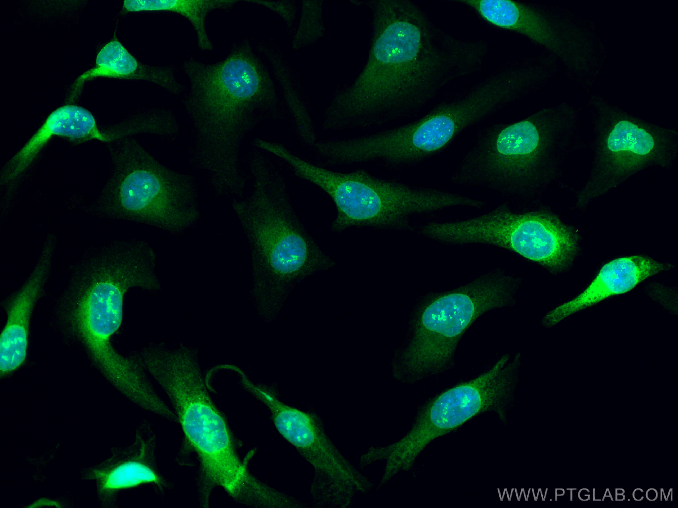 IF Staining of HeLa using CL488-12398