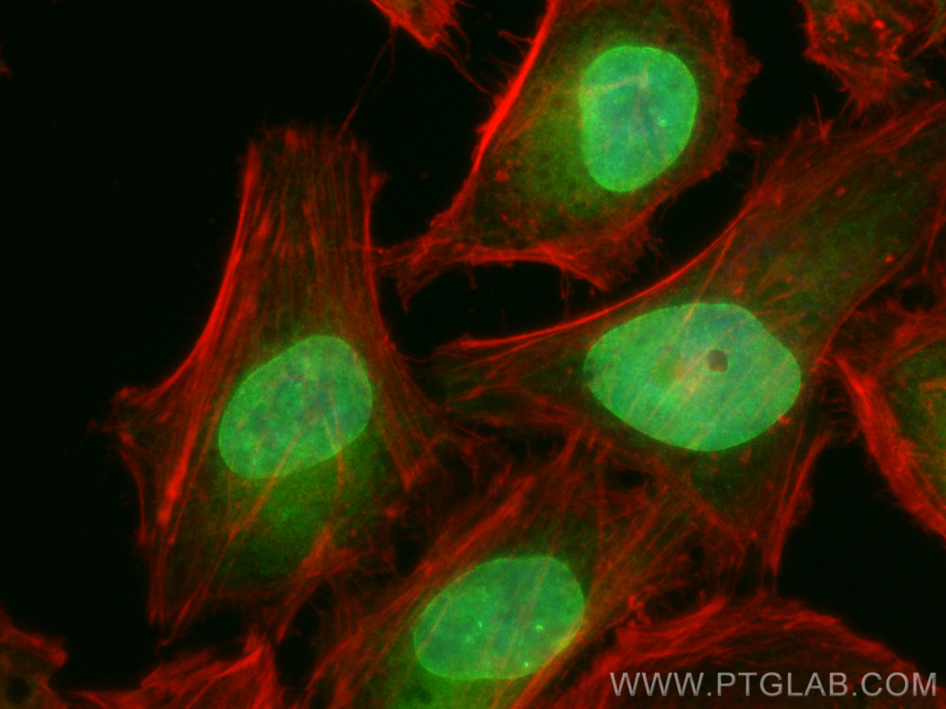 IF Staining of HeLa using CL488-12398